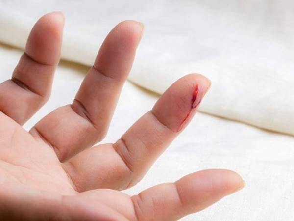 Trong giấc chiêm bao thấy người thân bị đứt tay chảy máu